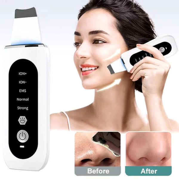 Ultrasonic Skin Scrubber Peeling Blackhead Remover Deep Face Cleaning Ultrasonic Ion Ance Pore Cleaner Facial Shovel Cleanser